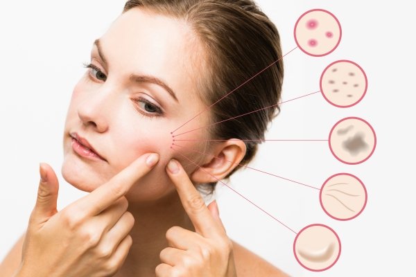 Everything you need to know about skin disorders 